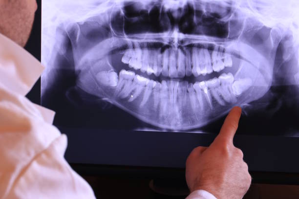 Best Broken or Chipped Tooth Repair in Winnetka, IL