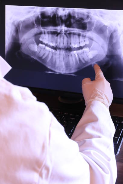 Best Emergency Treatment for Oral Infections in Winnetka, IL