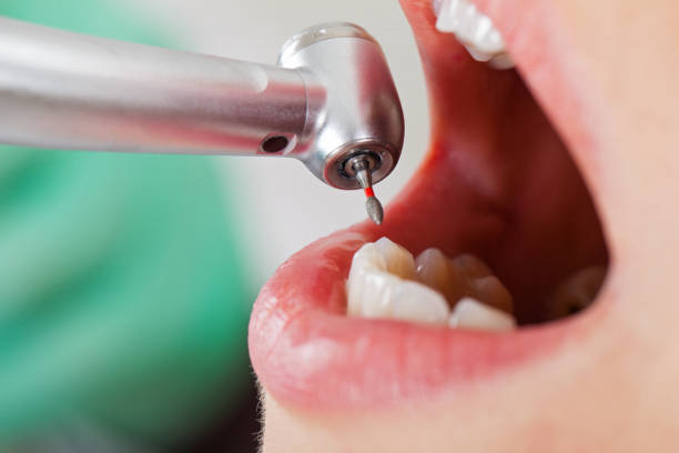 Best Emergency Pediatric Dental Care in Winnetka, IL